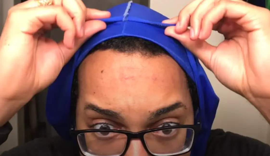 How To Prevent Forehead Acne (Small Pimples) - No Durag Lines